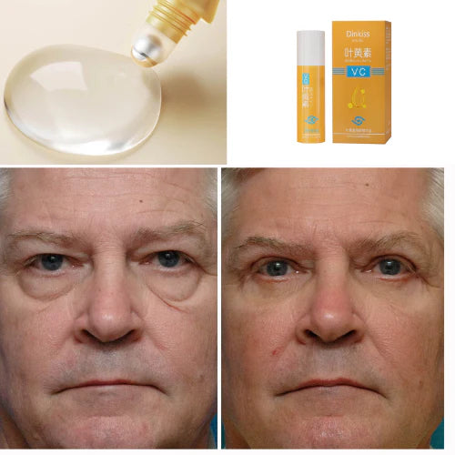 Roll-On 5 em 1 Ultra Rejuvenescedor Luteína Glow®