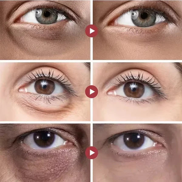 Roll-On 5 em 1 Ultra Rejuvenescedor Luteína Glow®