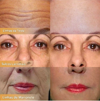 Creme Facial Reafirmante com Polipeptídeos — Transforme Sua Pele em 1 Semanas