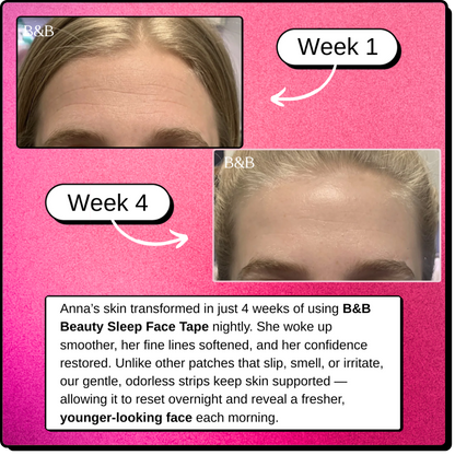 Beauty Sleep Face Tape