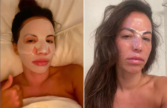 BiocollagenPlus - Máscara absorvível de colágeno + ativos do botox.