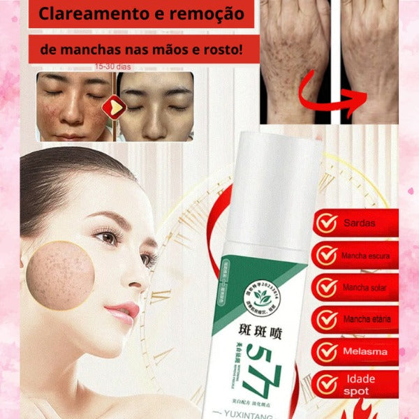 Spray Clareador de Manchas de Sol, Idade e Melasma +Brindes +Frete GRÁTIS!