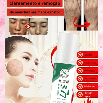 Spray Clareador de Manchas de Sol, Idade e Melasma +Brindes +Frete GRÁTIS!