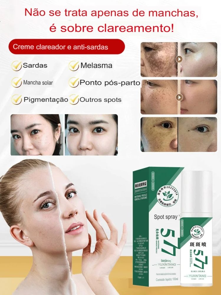 Spray Clareador de Manchas de Sol, Idade e Melasma +Brindes +Frete GRÁTIS!