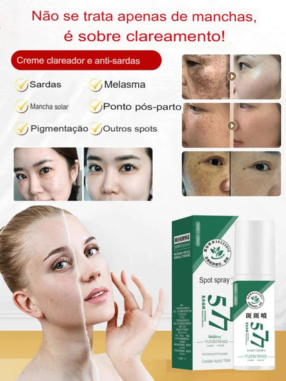 Spray Clareador de Manchas de Sol, Idade e Melasma +Brindes +Frete GRÁTIS!